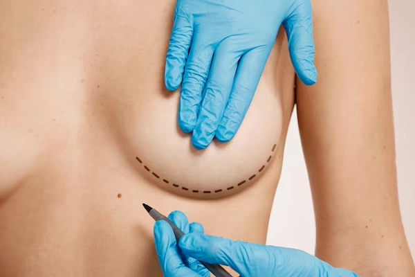 Breast Reduction